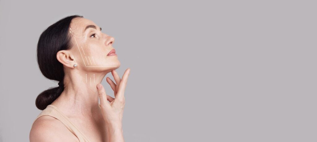 ageing skin treatment lifting arrows showing facial anti-aging treatment